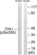 Western blot analysis of extracts from HUVEC cells treated with UV using Chk1 (Phospho-Ser296) Antibody.The lane on the right is treated with the antigen-specific peptide.