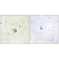 Immunohistochemistry analysis of paraffin-embedded human brain tissue using CELSR3 antibody.