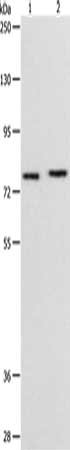 Gel: 8%SDS-PAGE, Lysate: 40 ug, Lane 1-2: 231 cells, A549 cells, Primary antibody: CSB-PA982049(PEG10 Antibody) at dilution 1/200, Secondary antibody: Goat anti rabbit IgG at 1/8000 dilution, Exposure time: 1 minute