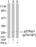Western blot analysis of extracts from Hela cells untreated or treated with EGF, IFN-a using p27Kip1(Phospho-Thr187) Antibody.