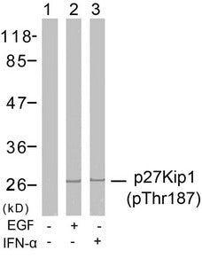 Western blot analysis of extracts from Hela cells untreated or treated with EGF, IFN-a using p27Kip1(Phospho-Thr187) Antibody.