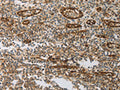 The image on the left is immunohistochemistry of paraffin-embedded Human tonsil tissue using CSB-PA982317(PECAM1 Antibody) at dilution 1/30, on the right is treated with synthetic peptide. (Original magnification: ×200)
