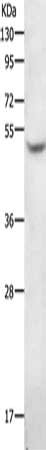 Gel: 10%SDS-PAGE, Lysate: 40 ug, Lane: Human liver cancer tissue, Primary antibody: CSB-PA982509(AGT Antibody) at dilution 1/300, Secondary antibody: Goat anti rabbit IgG at 1/8000 dilution, Exposure time: 5 minutes