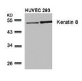 Western blot analysis of extracts from HUVEC and 293 cells using Keratin 8(Ab-74) Antibody.
