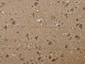 The image on the left is immunohistochemistry of paraffin-embedded Human brain tissue using CSB-PA982747(PTK2B Antibody) at dilution 1/30, on the right is treated with fusion protein. (Original magnification: ×200)