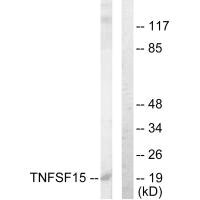 Western blot analysis of extracts from COLO205 cells, using TNFSF15 antibody.
