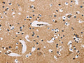 The image on the left is immunohistochemistry of paraffin-embedded Human brain tissue using CSB-PA983266(ATP2C1 Antibody) at dilution 1/50, on the right is treated with fusion protein. (Original magnification: ×200)