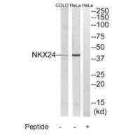 Western blot analysis of extracts from HeLa and COLO205 cells, using NKX24 antibody.