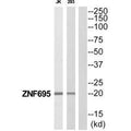 Western blot analysis of extracts from Jurkat/293 cells, using ZNF695 antibody.