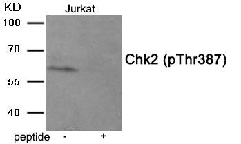 Western blot analysis of extracts from Jurkat tissue using Chk2 (Phospho-Thr387) antibody.The lane on the right is treated with the antigen-specific peptide.