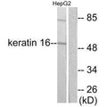 Western blot analysis of extracts from HepG2 cells, using Keratin 16 antibody.