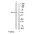 Western blot analysis of extracts from Jurkat cells, using IFIT5 antibody.