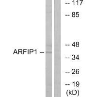 Western blot analysis of extracts from Jurkat cells, using ARFIP1 antibody.
