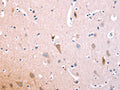 The image on the left is immunohistochemistry of paraffin-embedded Human brain tissue using CSB-PA984274(IL1RL1 Antibody) at dilution 1/70, on the right is treated with fusion protein. (Original magnification: ×200)
