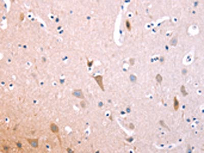 The image on the left is immunohistochemistry of paraffin-embedded Human brain tissue using CSB-PA984274(IL1RL1 Antibody) at dilution 1/70, on the right is treated with fusion protein. (Original magnification: ×200)