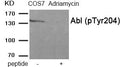 Western blot analysis of extracts from COS7 cells treated with Adriamycin using Abl (Phospho-Tyr204) antibody.The lane on the right is treated with the antigen-specific peptide.