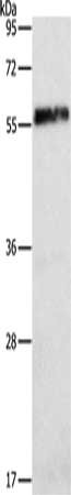 Gel: 10%SDS-PAGE, Lysate: 40 ug, Lane: Mouse brain tissue, Primary antibody: CSB-PA984943(HEXIM1 Antibody) at dilution 1/325, Secondary antibody: Goat anti rabbit IgG at 1/8000 dilution, Exposure time: 10 seconds