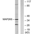 Western blot analysis of extracts from 293 cells, using MAP2K6 antibody.