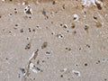 The image on the left is immunohistochemistry of paraffin-embedded Human brain tissue using CSB-PA985220(GYS1 Antibody) at dilution 1/50, on the right is treated with fusion protein. (Original magnification: ×200)