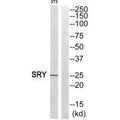 Western blot analysis of extracts from HeLa cells, using SRY antibody.