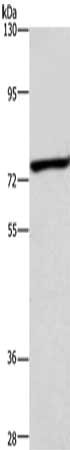 Gel: 6%SDS-PAGE, Lysate: 40 ug, Lane: Mouse heart tissue, Primary antibody: CSB-PA985454(ABCB8 Antibody) at dilution 1/600, Secondary antibody: Goat anti rabbit IgG at 1/8000 dilution, Exposure time: 40 seconds