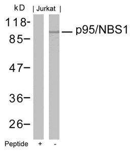 Western blot analysis of extracts from Jurkat cells using p95/NBS1(Ab-343) Antibody and the same antibody preincubated with blocking peptide.