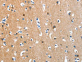 The image on the left is immunohistochemistry of paraffin-embedded Human brain tissue using CSB-PA986263(ANKMY1 Antibody) at dilution 1/30, on the right is treated with fusion protein. (Original magnification: ×200)