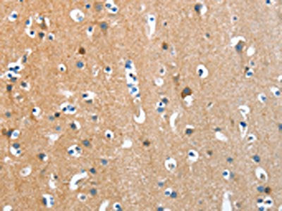 The image on the left is immunohistochemistry of paraffin-embedded Human brain tissue using CSB-PA986263(ANKMY1 Antibody) at dilution 1/30, on the right is treated with fusion protein. (Original magnification: ×200)