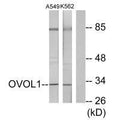 Western blot analysis of extracts from K562 cells and A549 cells, using OVOL1 antibody.