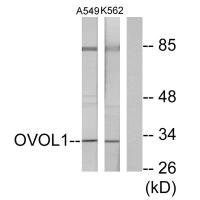 Western blot analysis of extracts from K562 cells and A549 cells, using OVOL1 antibody.