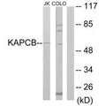 Western blot analysis of extracts from Jurkat cells and COLO205 cells, using KAPCB antibody.