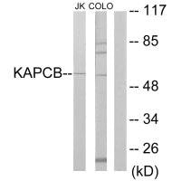 Western blot analysis of extracts from Jurkat cells and COLO205 cells, using KAPCB antibody.