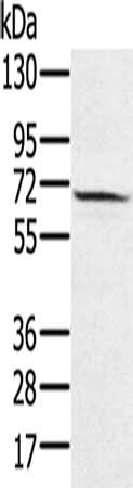 Gel: 10%SDS-PAGE, Lysate: 40 ug, Lane: Hela cells, Primary antibody: CSB-PA987633(HSF2 Antibody) at dilution 1/550, Secondary antibody: Goat anti rabbit IgG at 1/8000 dilution, Exposure time: 2 minutes