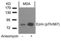 Western blot analysis of extracts from MDA cells untreated or treated with anisomycin using Ezrin(Phospho-Thr567) Antibody.
