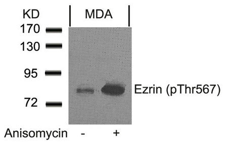 Western blot analysis of extracts from MDA cells untreated or treated with anisomycin using Ezrin(Phospho-Thr567) Antibody.