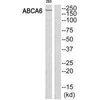 Western blot analysis of extracts from 293 cells, using ABCA6 antibody.