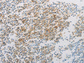 The image on the left is immunohistochemistry of paraffin-embedded Human tonsil tissue using CSB-PA988424(ADM Antibody) at dilution 1/20, on the right is treated with synthetic peptide. (Original magnification: ×200)