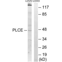 Western blot analysis of extracts from LOVO cells, using AGPAT5 antibody.