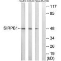 Western blot analysis of extracts from HuvEc cells, COLO cells and HeLa cells, using SIRPB1 antibody.
