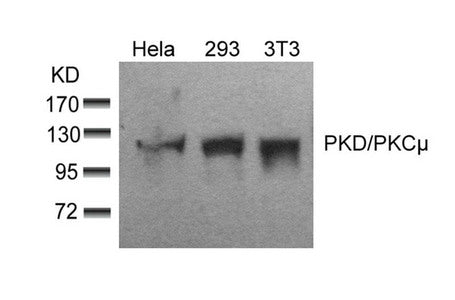 Western blot analysis of extracts from Hela, 293 and 3T3 cells using PKD/PKCm(Ab-910) Antibody.