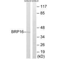 Western blot analysis of extracts from COLO cells, using BRP16 antibody.
