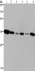 Gel: 8%SDS-PAGE, Lysate: 40 ug, Lane 1-6: 293T cells, MCF7 cells, human hepatocellular carcinoma tissue, Raji cells, A431 cells, A549 cells, Primary antibody: CSB-PA989949(EMD Antibody) at dilution 1/1200, Secondary antibody: Goat anti rabbit IgG at 1/8000 dilution, Exposure time: 5 seconds