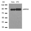Western blot analysis of extracts from Hela and 3T3 cells using p90RSK(Ab-348) Antibody.