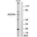 Western blot analysis of extracts from HepG2 cells, using ADCK4 antibody.