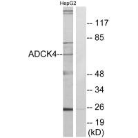Western blot analysis of extracts from HepG2 cells, using ADCK4 antibody.