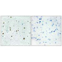 Immunohistochemistry analysis of paraffin-embedded human brain tissue, using DCLK3 antibody.