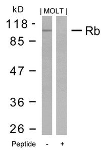 Western blot analysis of extracts from MOLT cells using Rb(Ab-795) Antibody and the same antibody preincubated with blocking peptide.