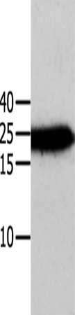 Gel: 12%SDS-PAGE, Lysate: 40 ug, Lane: Human cervical cancer tissue, Primary antibody: CSB-PA991332(ANXA5 Antibody) at dilution 1/750, Secondary antibody: Goat anti rabbit IgG at 1/8000 dilution, Exposure time: 1 minute