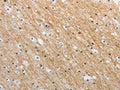 The image on the left is immunohistochemistry of paraffin-embedded Human brain tissue using CSB-PA992064(ADAMTS19 Antibody) at dilution 1/25, on the right is treated with synthetic peptide. (Original magnification: ×200)
