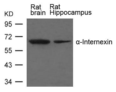 Western blot analysis of extract from Rat brain and Rat hippocampus Tissue using a-Internexin Antibody